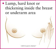 breast cancer 1