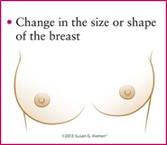 breast cancer 3